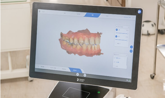 患者様の負担が少ないデジタル技工