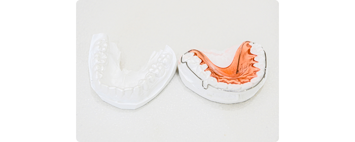 デジタル技工について