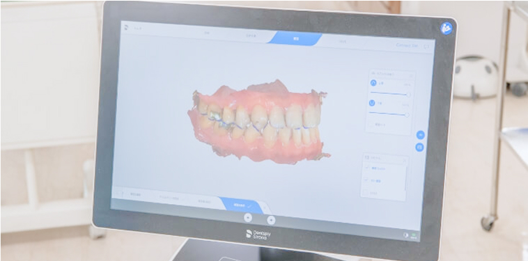 患者様の負担が少ないデジタル技工