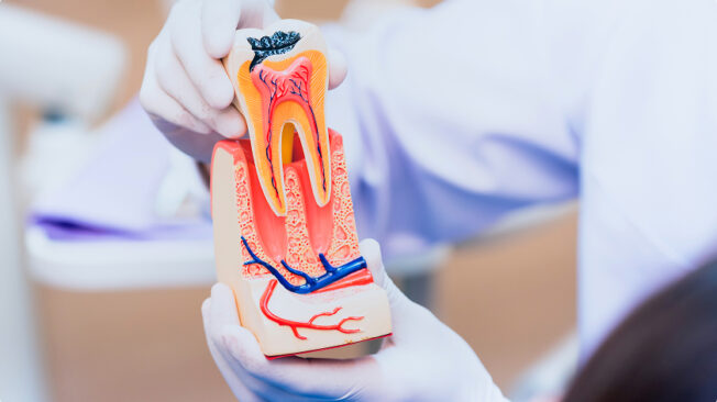 毎日のケアで差がつく！虫歯・歯周病予防のポイント2